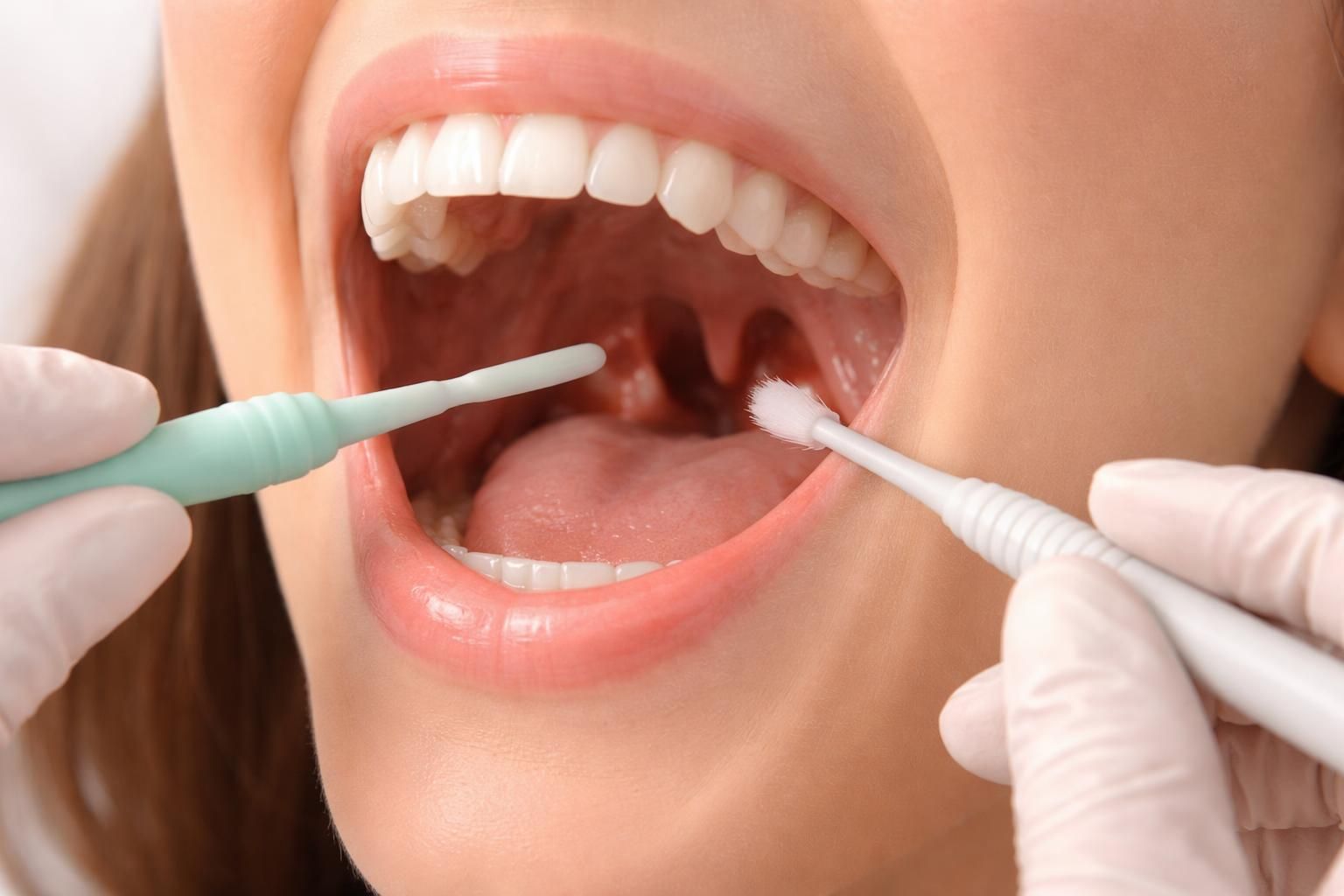 découvrez 10 astuces efficaces pour enlever le caséum sans vomir, et retrouvez un confort buccal rapidement et facilement.